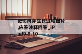 烫伤肉芽生长过程图片,应答注释回答_iPad9.9.10